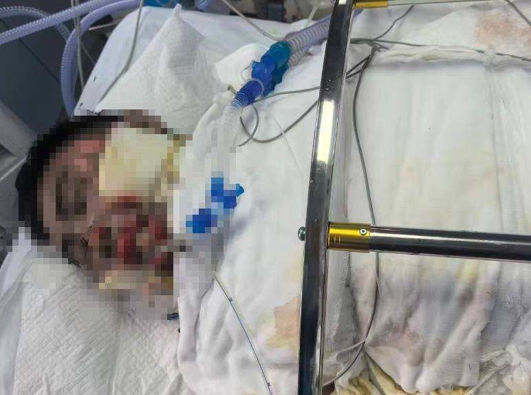 NBA美国职业篮球联赛
_滚烫的水NBA美国职业篮球联赛
,从头流到脚!今晚洗澡前紧急提醒!